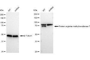 Western blotting analysis using Protein arginine methyltransferase 7 antibody (ABIN7799973). (Rekombinanter PRMT7 Antikörper)