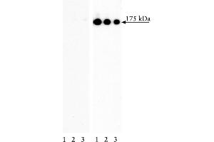 Western Blotting (WB) image for anti-Epidermal Growth Factor Receptor (EGFR) (pTyr845) antibody (ABIN967602) (EGFR Antikörper  (pTyr845))