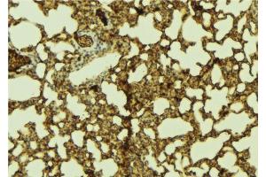 ABIN6274305 at 1/100 staining Mouse lung tissue by IHC-P.