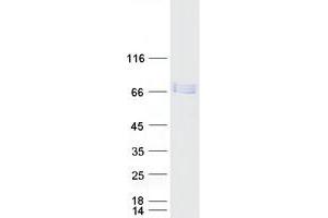 Validation with Western Blot