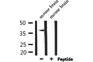 Western blot analysis of extracts from mouse brain, using AKR1C3 Antibody. (AKR1C3 Antikörper)