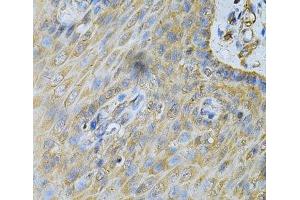 Immunohistochemistry of paraffin-embedded Human esophagus using PDGFB Polyclonal Antibody at dilution of 1:100 (40x lens). (PDGFB Antikörper)