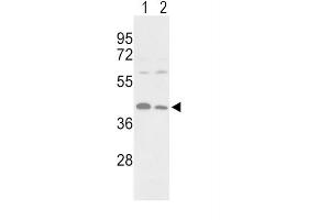 Western Blotting (WB) image for anti-Phosphoglycerate Kinase 1 (PGK1) antibody (ABIN3002985) (PGK1 Antikörper)