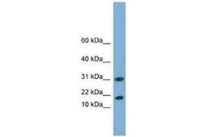 Image no. 1 for anti-Eukaryotic Translation Initiation Factor 5A2 (EIF5A2) (N-Term) antibody (ABIN6744192) (EIF5A2 Antikörper  (N-Term))