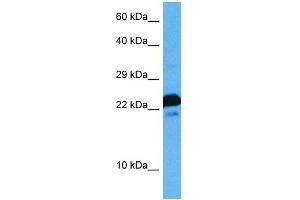 Host:  Rat  Target Name:  MAFG  Sample Tissue:  Rat Skeletal Muscle  Antibody Dilution:  1ug/ml (Mafg Antikörper  (N-Term))