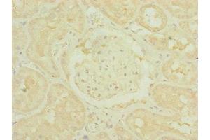 Immunohistochemistry of paraffin-embedded human kidney tissue using ABIN7159887 at dilution of 1:100 (TIMM1B (AA 1-103) Antikörper)