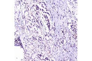 IHC analysis of cortactin using anti-cortactin antibody (ABIN6719306).