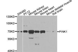Western blot analysis of extracts of various cell lines, using PINK1 antibody (ABIN5998524) at 1/1000 dilution. (PINK1 Antikörper)