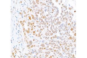 Immunohistochemistry (IHC) image for anti-MutL Homolog 1 (MLH1) (AA 450-500) antibody (ABIN7455102) (Rekombinanter MLH1 Antikörper  (AA 450-500))