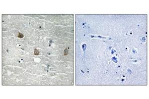 Immunohistochemical analysis of paraffin-embedded human brain tissue using TOB1 (Phospho-Ser164) antibody (left)or the same antibody preincubated with blocking peptide (right). (Protein Tob1 (TOB1) (pSer164) Antikörper)
