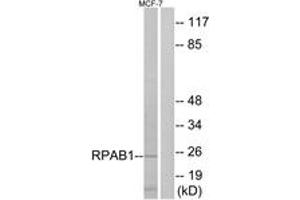 Western blot analysis of extracts from MCF-7 cells, using RPAB1 Antibody.
