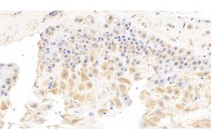 anti-Selectin P (Granule Membrane Protein 140kDa, Antigen CD62) (SELP) (AA 198-432) antibody