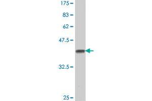 Western Blot detection against Immunogen (38. (CHRNB4 Antikörper  (AA 68-177))