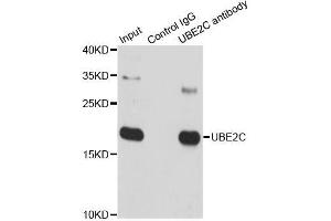 Immunoprecipitation analysis of 150 μg extracts of SW620 cells using 3 μg UBE2C antibody (ABIN5973207). (UBE2C Antikörper)