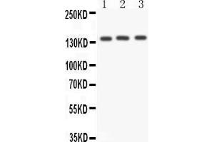 Western Blotting (WB) image for anti-Angiotensin I Converting Enzyme (Peptidyl-Dipeptidase A) 1 (ACE) (AA 702-715), (Middle Region) antibody (ABIN3042841)
