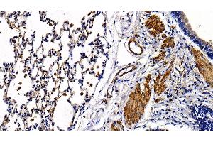 Immunohistochemistry (IHC) image for anti-Toll-Like Receptor 5 (TLR5) (AA 325-644) antibody (ABIN7444148)
