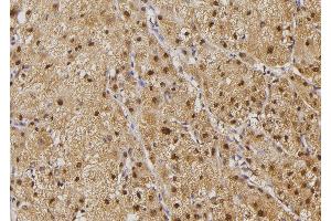 ABIN6274503 at 1/100 staining Human liver tissue by IHC-P. (ILKAP Antikörper  (N-Term))