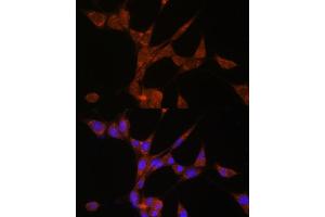 Immunofluorescence (IF) image for anti-Aldo-Keto Reductase Family 1, Member C3 (3-alpha Hydroxysteroid Dehydrogenase, Type II) (AKR1C3) (AA 1-323) antibody (ABIN3022536)