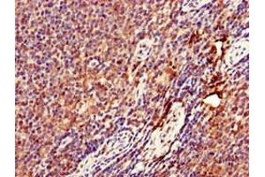 Immunohistochemistry of paraffin-embedded human lymph node tissue using ABIN7149671 at dilution of 1:100
