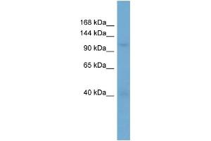 WB Suggested Anti-RANBP5  Antibody Titration: 0. (Importin 5 Antikörper  (N-Term))