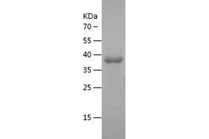 Western Blotting (WB) image for Neuroblastoma 1, DAN Family BMP Antagonist (NBL1) (AA 17-181) protein (His-IF2DI Tag) (ABIN7283526) (NBL1 Protein (AA 17-181) (His-IF2DI Tag))