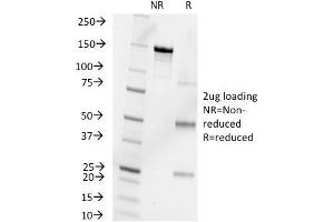 SDS-PAGE Analysis Purified Progesterone Mouse Monoclonal Antibody (6-5E-10B). (Progesterone Antikörper)