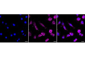 anti-Guanine Nucleotide Binding Protein (G Protein), Q Polypeptide (GNAQ) antibody