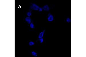 Detection of cathepsin B (CB) activity in Eca-109 cells by the CB probe. (Ziege anti-Kaninchen IgG Antikörper (FITC))