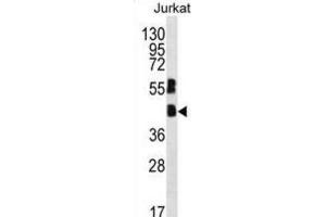Western Blotting (WB) image for anti-Transcription Factor MafB (MAFB) antibody (ABIN2996606) (MAFB Antikörper)