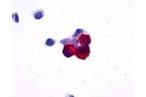 Anti-NPY5R antibody immunocytochemistry (ICC) staining of HEK293 human embryonic kidney cells transfected with NPY5R. (NPY5R Antikörper  (Cytoplasmic Domain))