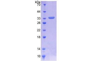 SDS-PAGE analysis of Human ILK Protein. (ILK Protein)