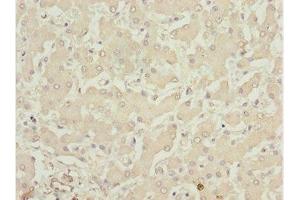 Immunohistochemistry of paraffin-embedded human liver tissue using ABIN7158391 at dilution of 1:100 (LHX6 Antikörper  (AA 114-363))