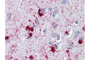 Brain, cortex, Human: Formalin-Fixed, Paraffin-Embedded (FFPE)