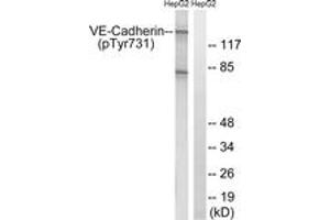 Western blot analysis of extracts from HepG2 cells treated with Na3VO4 0. (Cadherin 5 Antikörper  (pTyr731))