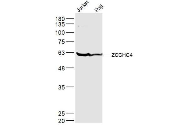 ZCCHC4 Antikörper  (AA 301-400)