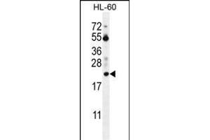PT Antibody (N-term) (ABIN655715 and ABIN2845165) western blot analysis in HL-60 cell line lysates (35 μg/lane). (PTMA Antikörper  (N-Term))