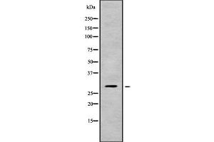 Western blot analysis of CHAC1 using Jurkat whole cell lysates (CHAC1 Antikörper  (Internal Region))