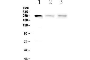 Western blot analysis of MYLK using anti-MYLK antibody .