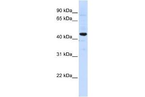 SLC41A3 antibody used at 1 ug/ml to detect target protein. (SLC41A3 Antikörper  (C-Term))