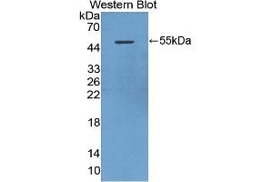 Detection of Recombinant DAPK3, Mouse using Polyclonal Antibody to Death Associated Protein Kinase 3 (DAPK3) (DAPK3 Antikörper  (AA 1-448))