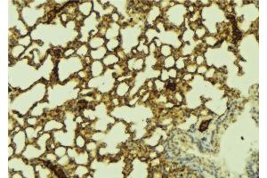 ABIN6269338 at 1/100 staining Mouse lung tissue by IHC-P. (FOXO1 Antikörper  (Internal Region))