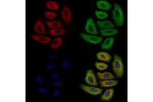 ABIN7094863 and ABIN7098915 staining Hela cells by IF/ICC. (p40 (p63 Delta) (Internal Region) Antikörper)