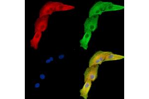 ABIN7096019 and ABIN7100081 staining  cells by IF/ICC.