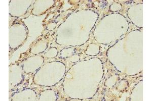 Immunohistochemistry of paraffin-embedded human thyroid tissue using ABIN7142322 at dilution of 1:100 (ACAA1 Antikörper  (AA 27-331))
