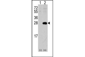 Image no. 1 for anti-sigma Non-Opioid Intracellular Receptor 1 (SIGMAR1) (N-Term) antibody (ABIN357896) (SIGMAR1 Antikörper  (N-Term))