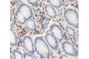IHC-P analysis of Human Stomach Tissue, with DAB staining. (TNF alpha Antikörper  (AA 77-233))