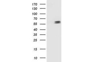 Western Blotting (WB) image for anti-Tumor Protein P53 (TP53) antibody (ABIN1499970) (p53 Antikörper)