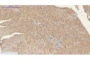 Immunohistochemistry of paraffin-embedded Mouse heart tissue using ENO2 Monoclonal Antibody at dilution of 1:200. (ENO2/NSE Antikörper)