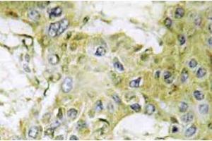 Immunohistochemistry (IHC) analyzes of Casein Kinase Igamma1 antibody in paraffin-embedded human brain tissue. (CSNK1G1 Antikörper)