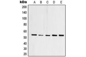 Western blot analysis of TFDP1 expression in HEK293T (A), A431 (B), Raji (C), mouse heart (D), PC12 (E) whole cell lysates.